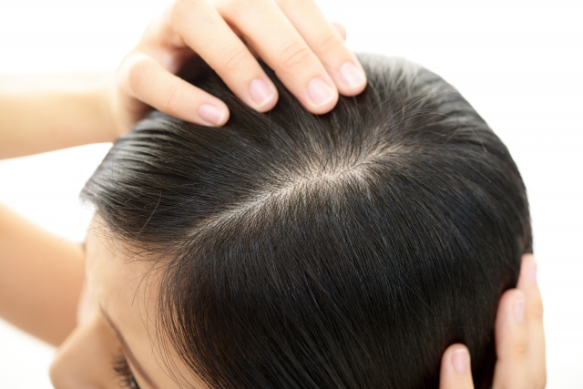 頭皮チェック